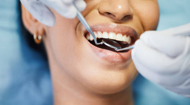 Best Emergency Dental Care for Trauma or Injury in Carrollton, AL