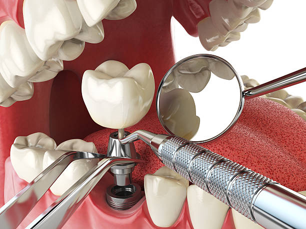 Best Emergency Dental Surgery in Carrollton, AL